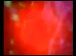 ब्लैक डैनी डोंग्स एं ...